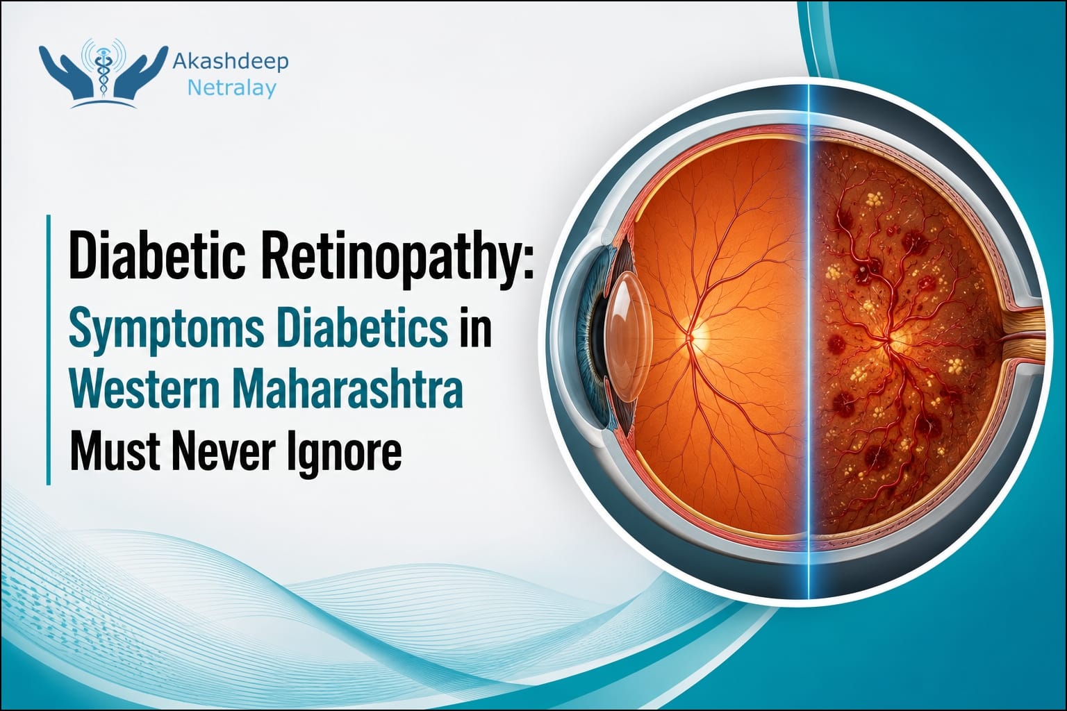 Diabetic retinopathy illustration comparing a healthy retina with a damaged retina